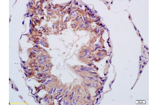 CMTM2 antibody  (AA 23-100)