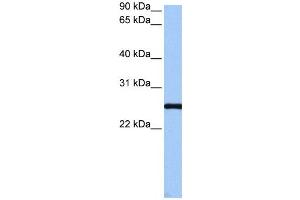 Western Blotting (WB) image for anti-Coiled-Coil Domain Containing 46 (CCDC46) antibody (ABIN2459718) (CCDC46 antibody)