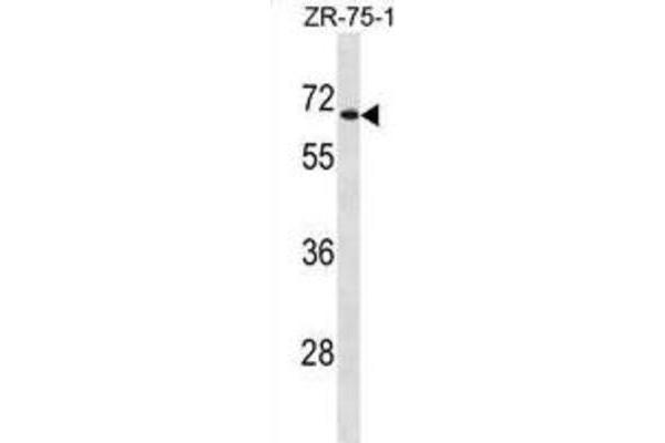 UGT2B28 antibody