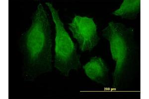 Immunofluorescence of monoclonal antibody to CAMK2B on HeLa cell. (CAMK2B antibody  (AA 405-502))