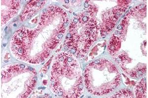 Human Kidney (formalin-fixed, paraffin-embedded) stained with CAT antibody ABIN214024 at 5 ug/ml followed by biotinylated goat anti-rabbit IgG secondary antibody ABIN481713, alkaline phosphatase-streptavidin and chromogen. (Catalase antibody)