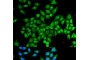 Immunofluorescence analysis of MCF-7 cells using DAO Polyclonal Antibody (D Amino Acid Oxidase antibody)