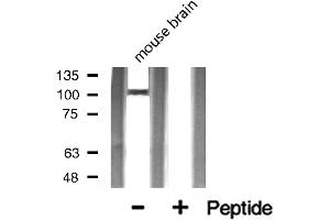 Western blot analysis of ACE2 expression in Mouse brain lysate (ACE2 antibody  (Internal Region))
