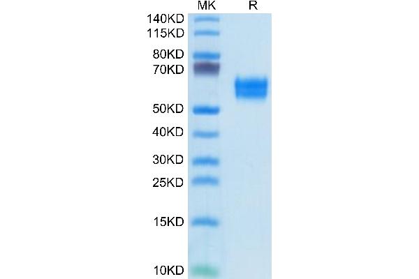 IL1R1 Protein (AA 18-332) (His tag)