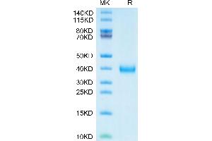 SARS-CoV-2 Spike RBD (Lambda C. (SARS-CoV-2 Spike Protein (C.37 - Lambda, RBD) (His tag))