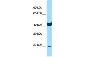 WB Suggested Anti-SCAMP4 Antibody Titration: 1.
