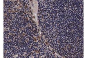 Immunohistochemistry (IHC) image for anti-Janus Kinase 2 (JAK2) (pTyr221) antibody (ABIN6256675)