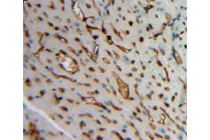 Used in DAB staining on fromalin fixed paraffin-embedded heart tissue (Angiopoietin 4 antibody  (AA 270-490))