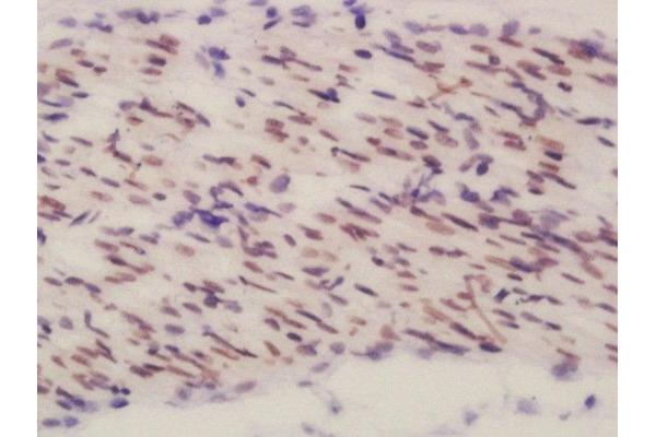 BEND3 antibody  (AA 501-600)