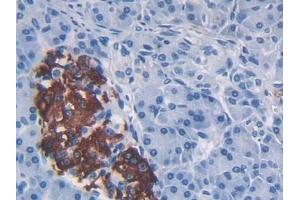 #VALUE! (CCL2 antibody  (AA 24-99))