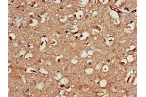 Immunohistochemistry of paraffin-embedded human brain tissue using ABIN7161445 at dilution of 1:100 (Neuroserpin antibody  (AA 191-240))