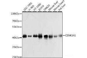 Western blot analysis of extracts of various cell lines using CSNK2A1 Polyclonal Antibody at dilution of 1:1000. (CSNK2A1/CK II alpha antibody)