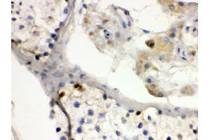 Anti- DMRT1 antibody,IHC(P) IHC(P): Human Testis Tissue (DMRT1 antibody  (N-Term))