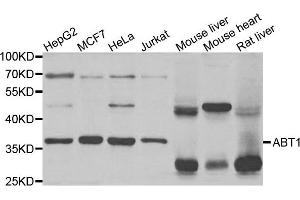 Western Blotting (WB) image for anti-Activator of Basal Transcription 1 (Abt1) antibody (ABIN1876937) (Activator of Basal Transcription 1 antibody)