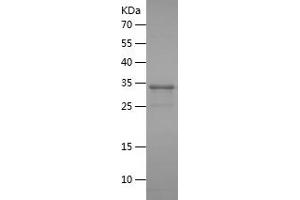 Western Blotting (WB) image for Hydroxysteroid (17-Beta) Dehydrogenase 3 (HSD17B3) (AA 67-178) protein (His-IF2DI Tag) (ABIN7123390) (HSD17B3 Protein (AA 67-178) (His-IF2DI Tag))