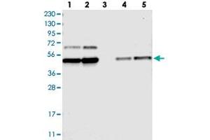 Western blot analysis of Lane 1: RT-4, Lane 2: U-251 MG, Lane 3: Human Plasma, Lane 4: Liver, Lane 5: Tonsil with FAM172A polyclonal antibody  at 1:250-1:500 dilution.