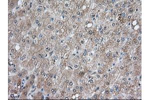 Immunohistochemical staining of paraffin-embedded Human prostate tissue using anti-BCL10 mouse monoclonal antibody. (BCL10 antibody)