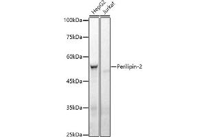 Western blot analysis of extracts of various cell lines, using Perilipin-2 antibody (ABIN7269220) at 1:1000 dilution. (ADRP antibody)