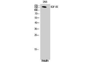Western Blotting (WB) image for anti-Insulin-Like Growth Factor 1 Receptor (IGF1R) (Ser52) antibody (ABIN3185134) (IGF1R antibody  (Ser52))