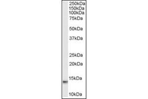 Image no. 1 for anti-Macrophage Migration Inhibitory Factor (Glycosylation-Inhibiting Factor) (MIF) (C-Term) antibody (ABIN374566) (MIF antibody  (C-Term))