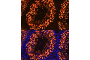 Immunofluorescence analysis of Rat testis cells using PIWIL1 antibody (ABIN3023049, ABIN3023050, ABIN3023051 and ABIN6219364) at dilution of 1:100. (PIWIL1 antibody)