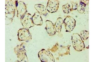 Immunohistochemistry of paraffin-embedded human placenta tissue using ABIN7153663 at dilution of 1:100 (Non-Syndromic Hearing Impairment Protein 5 (GSDME) (AA 1-260) antibody)