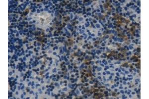 Detection of LSP1 in Rat Lymph node Tissue using Polyclonal Antibody to Lymphocyte Specific Protein 1 (LSP1) (LSP1 antibody  (AA 127-331))