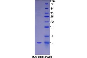 SDS-PAGE analysis of Human FGF3 Protein. (FGF3 Protein)