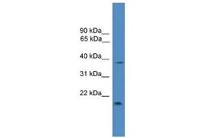 WB Suggested Anti-TIMP3 Antibody Titration: 0. (TIMP3 antibody  (Middle Region))