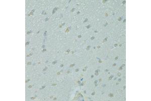 Immunohistochemistry of paraffin-embedded rat brain using NCOA2 antibody. (NCOA2 antibody)