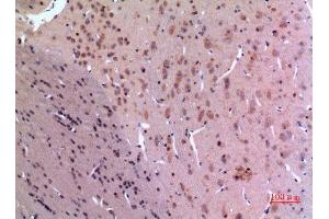 Immunohistochemistry (IHC) analysis of paraffin-embedded Rat Brain, antibody was diluted at 1:100. (GDI2 antibody  (C-Term))