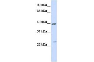 ACADL antibody used at 1 ug/ml to detect target protein. (ACADL antibody  (Middle Region))