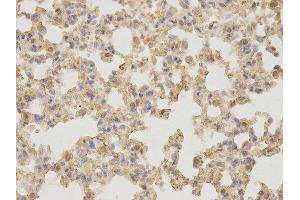 Immunohistochemistry (IHC) image for anti-alpha 1 Microglobulin/bikunin precursor (AMBP) antibody (ABIN1870956) (AMBP antibody)