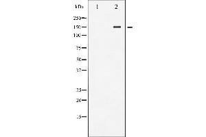 Western blot analysis of VEGFR2 phosphorylation expression in Na3VO4 treated HepG2 whole cell lysates,The lane on the left is treated with the antigen-specific peptide. (VEGFR2/CD309 antibody  (pTyr1214))