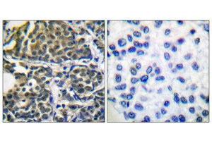 Immunohistochemistry (IHC) image for anti-Heat Shock Protein 90kDa alpha (Cytosolic), Class B Member 1 (HSP90AB1) (Ser254) antibody (ABIN1847890) (HSP90AB1 antibody  (Ser254))