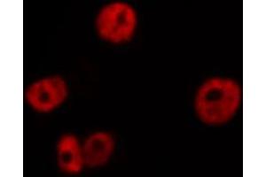 ABIN6266545 staining NIH-3T3 by IF/ICC. (GANP antibody  (C-Term))