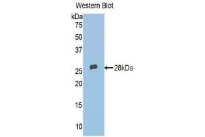 Detection of Recombinant ADRP, Human using Polyclonal Antibody to Adipose Differentiation Related Protein (ADRP) (ADRP antibody  (AA 5-232))