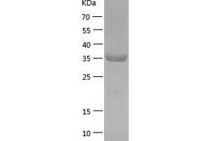 Western Blotting (WB) image for DNA (Cytosine-5-)-Methyltransferase 3 Like (TRDMT1) (AA 1-386) protein (His tag) (ABIN7122680) (DNMT3L Protein (AA 1-386) (His tag))