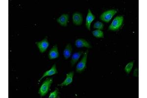 Immunofluorescence staining of A549 cells with ABIN7145367 at 1:133, counter-stained with DAPI. (B3GALT2 antibody  (AA 201-422))