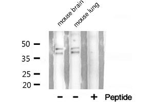 Western blot analysis of hnRNP A2/B1 expression in HepG2 cells (HNRNPA2B1 antibody  (N-Term))
