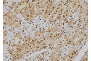 ABIN6273549 at 1/100 staining Human kidney tissue by IHC-P. (POGZ antibody  (Internal Region))