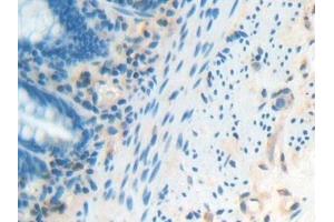 Detection of IFNa/bR1 in Human Rectum Tissue using Polyclonal Antibody to Interferon Alpha/Beta Receptor 1 (IFNa/bR1) (IFNAR1 antibody  (AA 28-227))