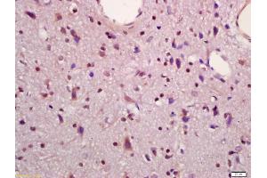 Formalin-fixed and paraffin embedded rat brain labeled with Anti-MAPKAPK5 Polyclonal Antibody, Unconjugated (ABIN754378) at 1:200 followed by conjugation to the secondary antibody and DAB staining (MAPKAP Kinase 5 antibody  (AA 89-190))