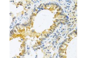 Immunohistochemistry of paraffin-embedded Mouse lung using IL20 Polyclonal Antibody at dilution of 1:100 (40x lens). (IL-20 antibody)