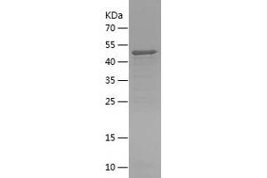 Western Blotting (WB) image for Abelson Helper Integration Site 1 (AHI1) (AA 1-335) protein (His tag) (ABIN7283390) (AHI1 Protein (AA 1-335) (His tag))