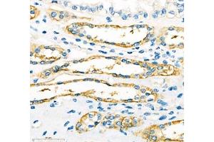 Immunohistochemistry of paraffin embedded human kidney using ATP1HC1 (ABIN7073160) at dilution of 1:500 (400x lens) (ATP12A antibody)