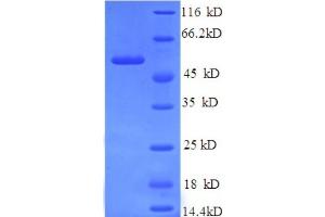 SDS-PAGE (SDS) image for Islet Cell Autoantigen 1, 69kDa (ICA1) (AA 1-268), (partial) protein (His tag) (ABIN4974706) (ICA1 Protein (AA 1-268, partial) (His tag))