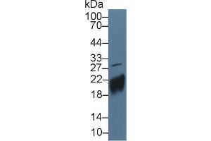 Western Blot; Sample: Human JAR cell lysate; ;Primary Ab: 5µg/ml Rabbit Anti-Human CGb Antibody;Second Ab: 0. (CGB antibody  (AA 31-165))