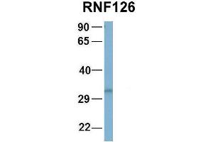 Host:  Rabbit  Target Name:  NOP56  Sample Type:  Human Fetal Brain  Antibody Dilution:  1. (RNF126 antibody  (N-Term))