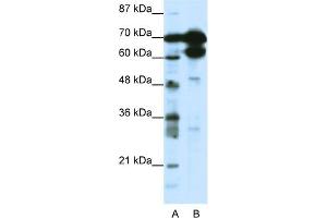 WB Suggested Anti-ZNF76 Antibody Titration:  1. (ZNF76 antibody  (N-Term))